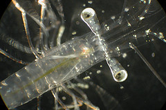 Microscopic zooplankton © NOAA Photo Library CC BY 2.0